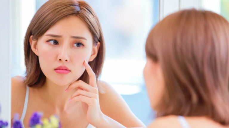 Acne What Causes Acne